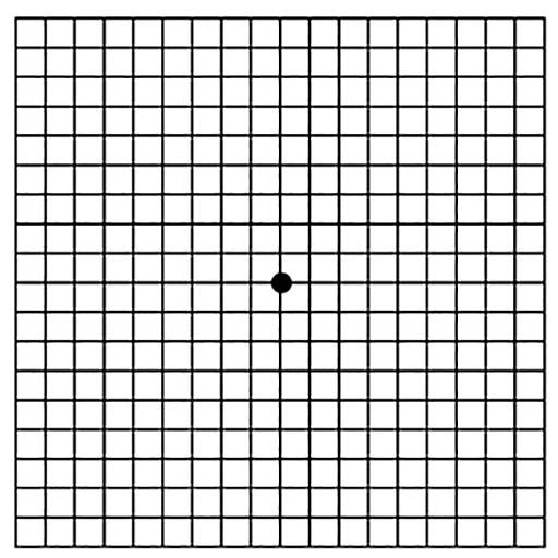 Macular-Degeneration-Vision figure